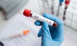 HIV enfeksiyonu, erken teşhis ve düzenli tedaviyle kontrol altında tutulabilir