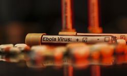 DSÖ: Uganda’da Ebola vakalarının 19’a yükseldiği açıklandı