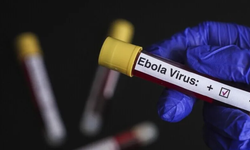 Ebola salgını KDC’de yayılıyor: Ölü sayısı 580’e çıktı