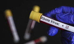 DSÖ: KDC’de Ebola salgınına karşı risk seviyesi yükseldi