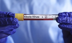 Kenya'da Ebola salgınına karşı önlemler sıkılaştırıldı