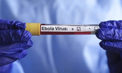 KDC'de Ebola vakaları 10 bini geçti: 4 bin 887 kişi hayatını kaybetti