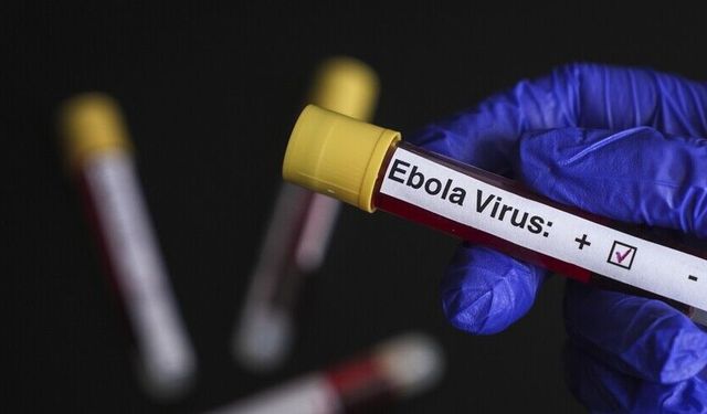 Uluslararası acil durum ilan edilmişti: KDC'de 900’den fazla Ebola vakası tespit edildi
