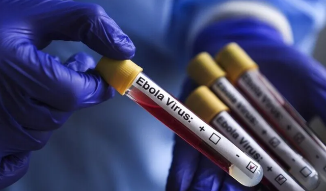 ABD'den Ebola kararı: Son 21 günde KDC'de bulunanlar uçuşlara alınmayacak